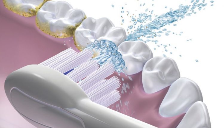 Waterpik Sonic Fusion is the world’s first water flossing toothbrush.